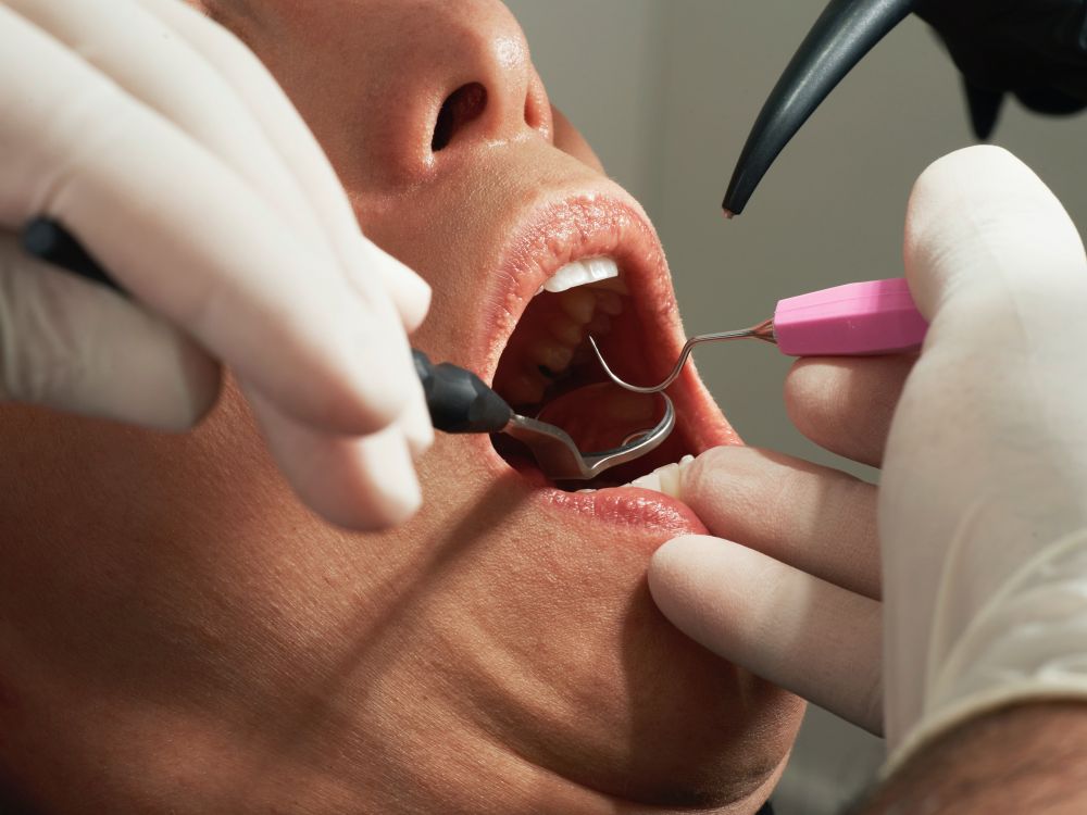 Se över din munhälsa hos en tandläkare